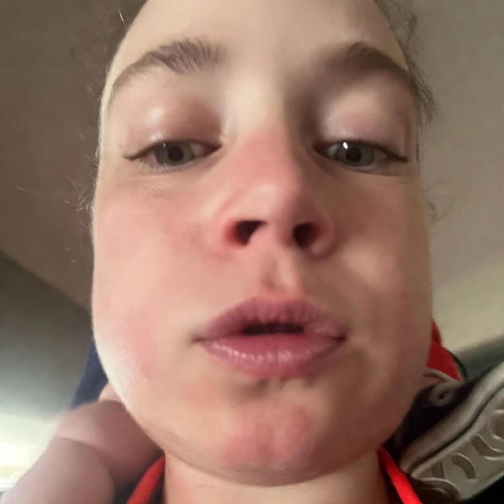 Red strap marks, dangling baby sneaker.